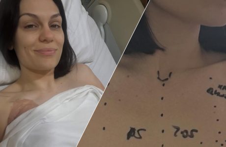 Jessie J ndan rrëfimin emocional pas operacionit të kancerit të gjirit