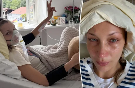 Bella Hadid shtrohet në spital