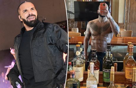 Drake mohon operacionet plastike, pranon se ka përdorur ‘Photoshop’