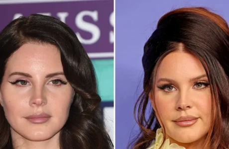 Lana Del Rey flet pas akuzave për operacione plastike