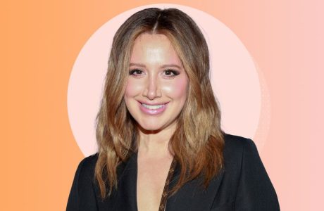 Ashley Tisdale rrëfen luftën e gjatë me çrregullimin “TMJ”