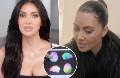 Kim Kardashian zbulon skanerin e trurit: “Aktivitet i ulët” mes stresit, provimeve dhe ankthit shëndetësor
