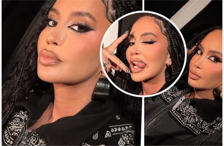 Dafina heq përfundimisht “fillerat” nga buzët