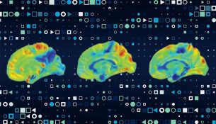 Demenca vjen në shumë forma: Alzheimeri është vetëm njëra prej tyre