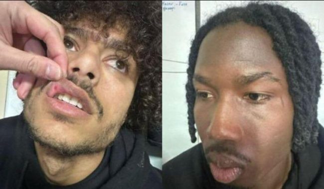 Tre pjesëtarë të Ilirisë nën hetim, pas dhunës ndaj ekipit të Skënderbeut