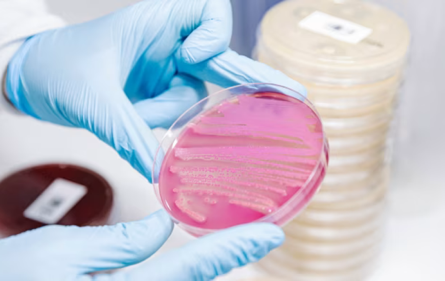 AI hap një kapitull të ri në krijimin e antibiotikëve kundër baktereve rezistente