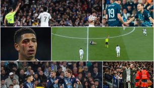 Real Madridi i bën të gjitha, por për keq…