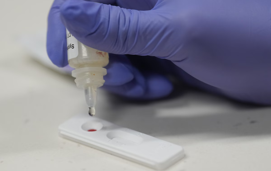 ADN-ja 5500-vjeçare tregon se sifilizi e ka origjinën në Amerikë