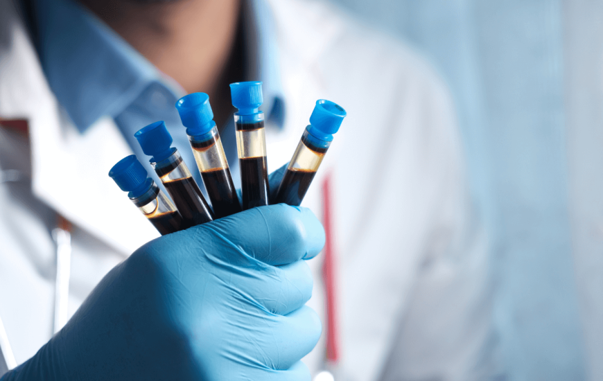 Pavarësisht hulumtimeve të pakta, kompanitë nxitojnë të lansojnë teste për autizmin