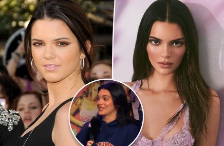 Kendall Jenner i kthen përgjigje ‘kirurgëve të TikTok’: “Nuk kam bërë asnjë operacion plastik në fytyrë”