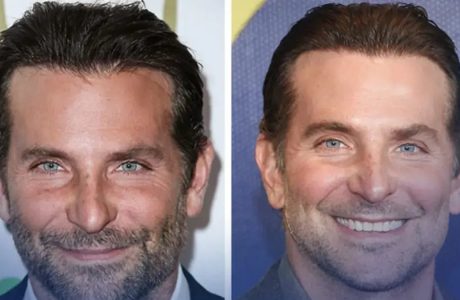 Bradley Cooper reagon për herë të parë ndaj thashethemeve për ndërhyrje plastike