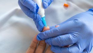 Testi i Alzheimerit me shpim gishti mund të ndihmojë në diagnostikim