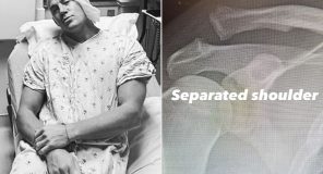 Channing Tatum përfundon në spital pas një lëndimi të rëndë