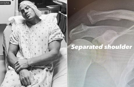 Channing Tatum përfundon në spital pas një lëndimi të rëndë