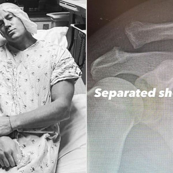 Channing Tatum përfundon në spital pas një lëndimi të rëndë