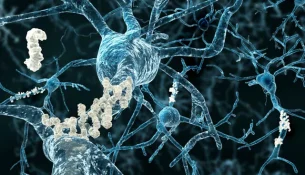 Terapia e kancerit e përdorur për të trajtuar Alzheimerin jep rezultate premtuese, thotë studimi