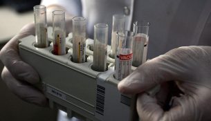 OBSH: Numri vjetor i infeksioneve të reja me Hepatitis B ka rënë me 32% globalisht