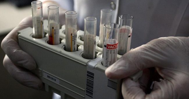 OBSH: Numri vjetor i infeksioneve të reja me Hepatitis B ka rënë me 32% globalisht