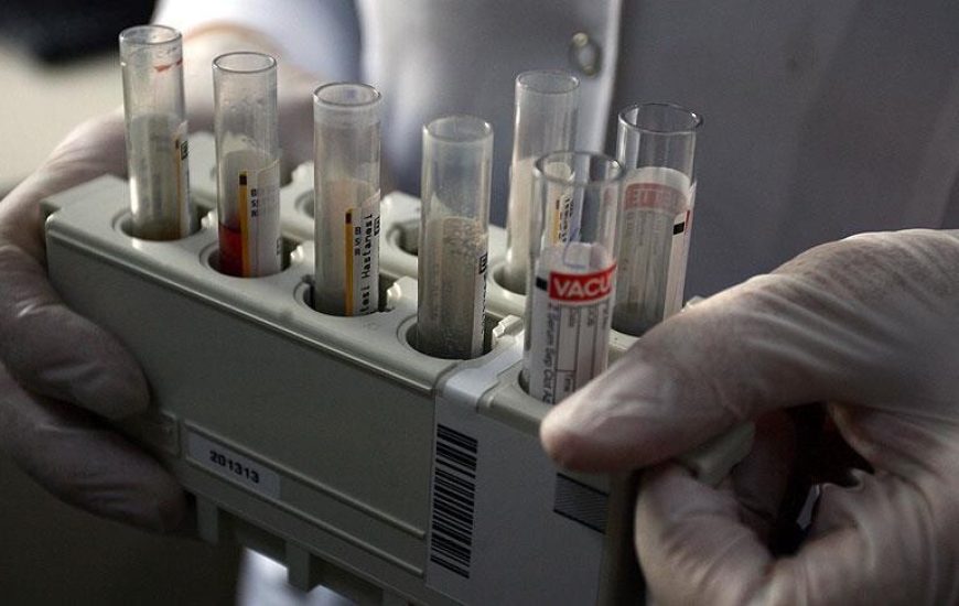 OBSH: Numri vjetor i infeksioneve të reja me Hepatitis B ka rënë me 32% globalisht