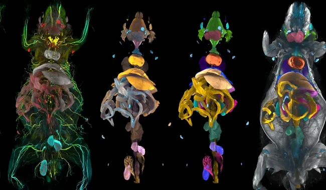 Inteligjenca artificiale krijon hartën 3D të dëmeve që shkakton obeziteti