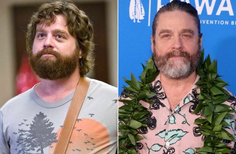 Zach Galifianakis: Fama nga “The Hangover” më ndryshoi jetën