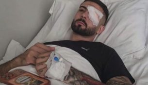 Prokuroria nis hetimet për rastin e Erjon Vishkullit dhe protestuesit e tjerë të dëmtuar