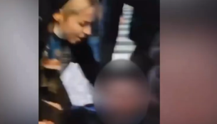 E rëndë/ Protestuesi qëllohet me fishek gome në sy gjatë protestës në Tiranë